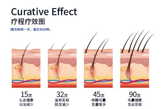 818大促在即，半岛HairPro电激光生发仪入驻网易严选