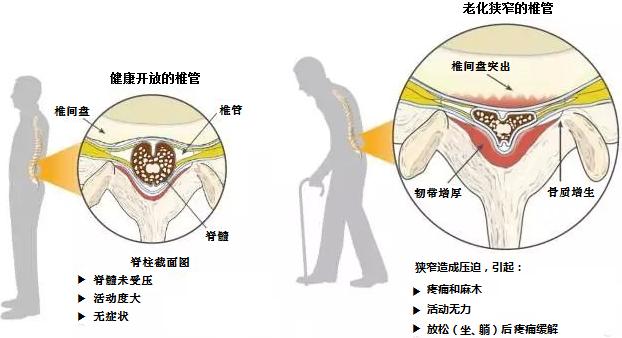 成语十什么如椎_成语故事简笔画(5)