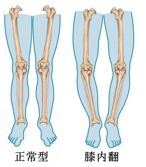 下肢骨关节增治疗的症状及缓减治疗