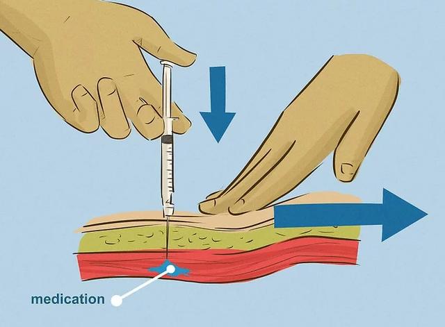 肌肉注射竟还有这么多玩法