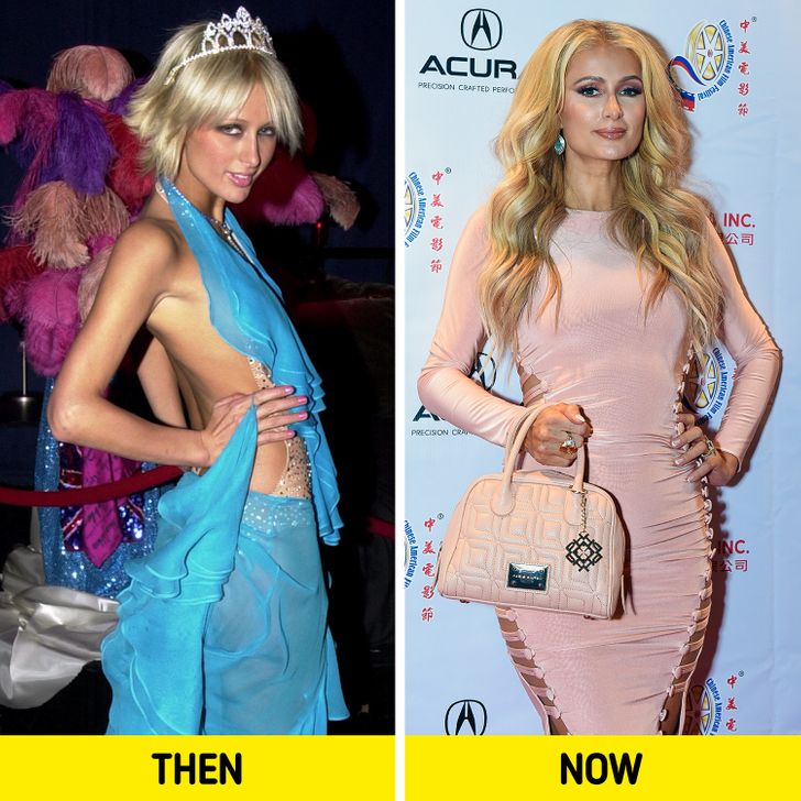 17 Celebrities Who Are Healthier And Happier After Giving Up On Diet Inews