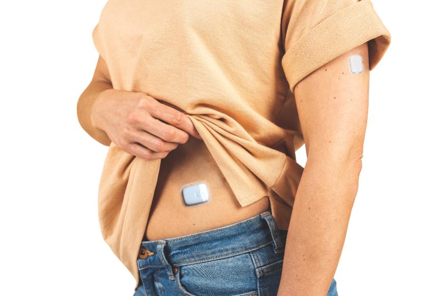 Yiyu Technology launched the fully automated closed-loop artificial pancreas, opening a new era of diabetes management