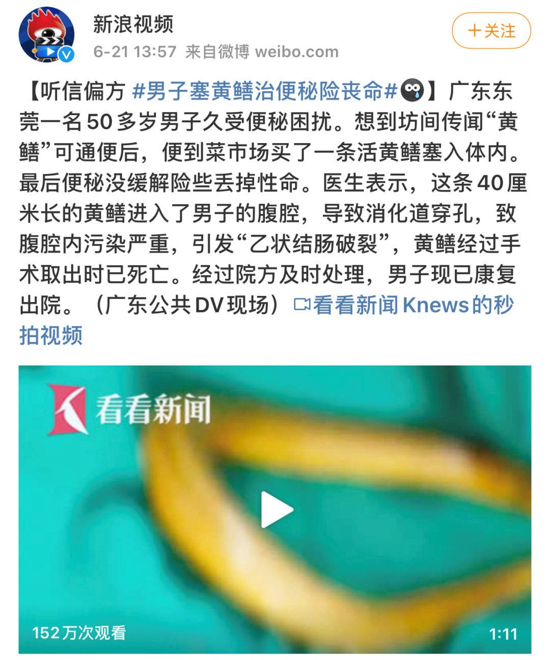 巴西男囚在屁股里藏8部手机4个插头，他这是把菊花当黑洞使？