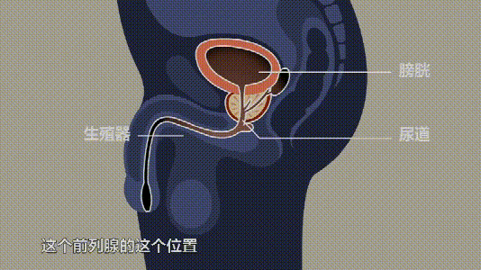 Examen microbiologic secret uretral/prostata - Synevo