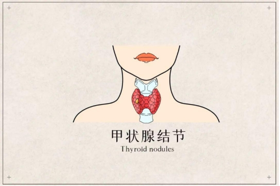 Retired Chinese Medicine Practitioner Sanjie Is Actually Very Simple Do 3 Things To Prevent Thyroid Disease Inews