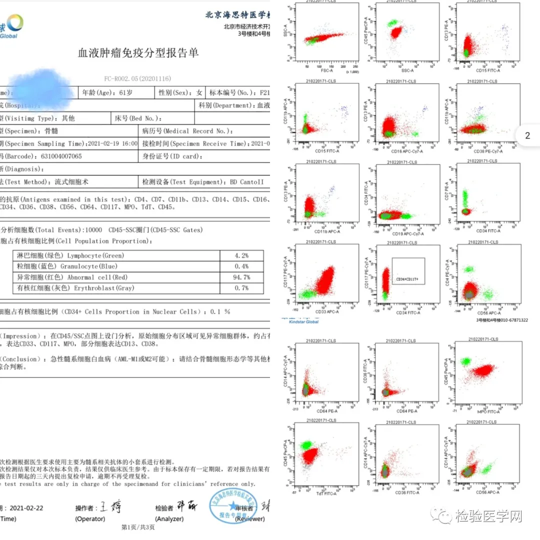 The White Blood Cells Are So High And Cup Mouth Cells Are Also Surprised What Happened To The Patient Inews
