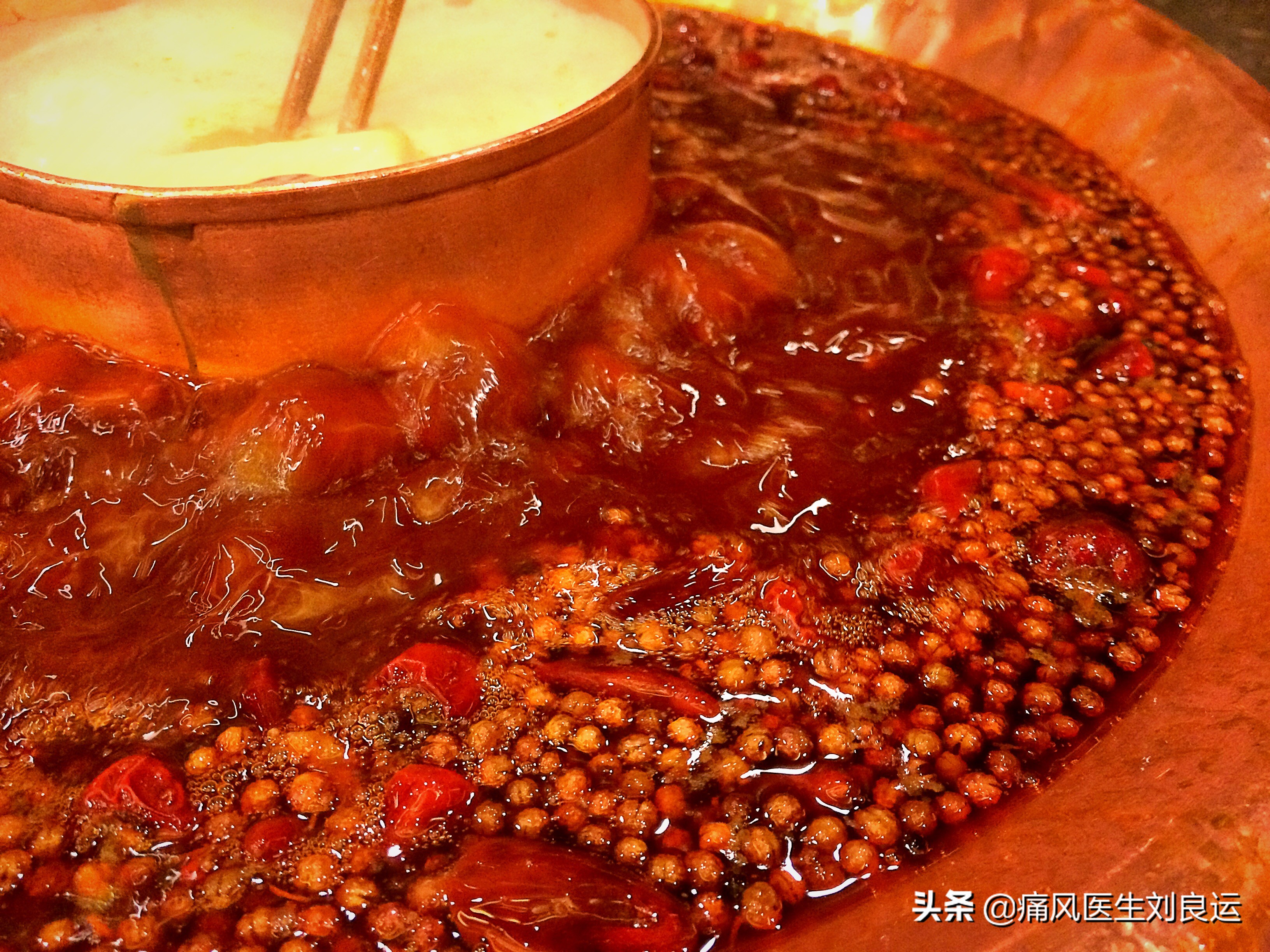 The Effect Of Gout In Chinese Pepper Feet Can Pepper Lower Uric Acid Can T Eat Chili For Gout The Doctor Said Inews