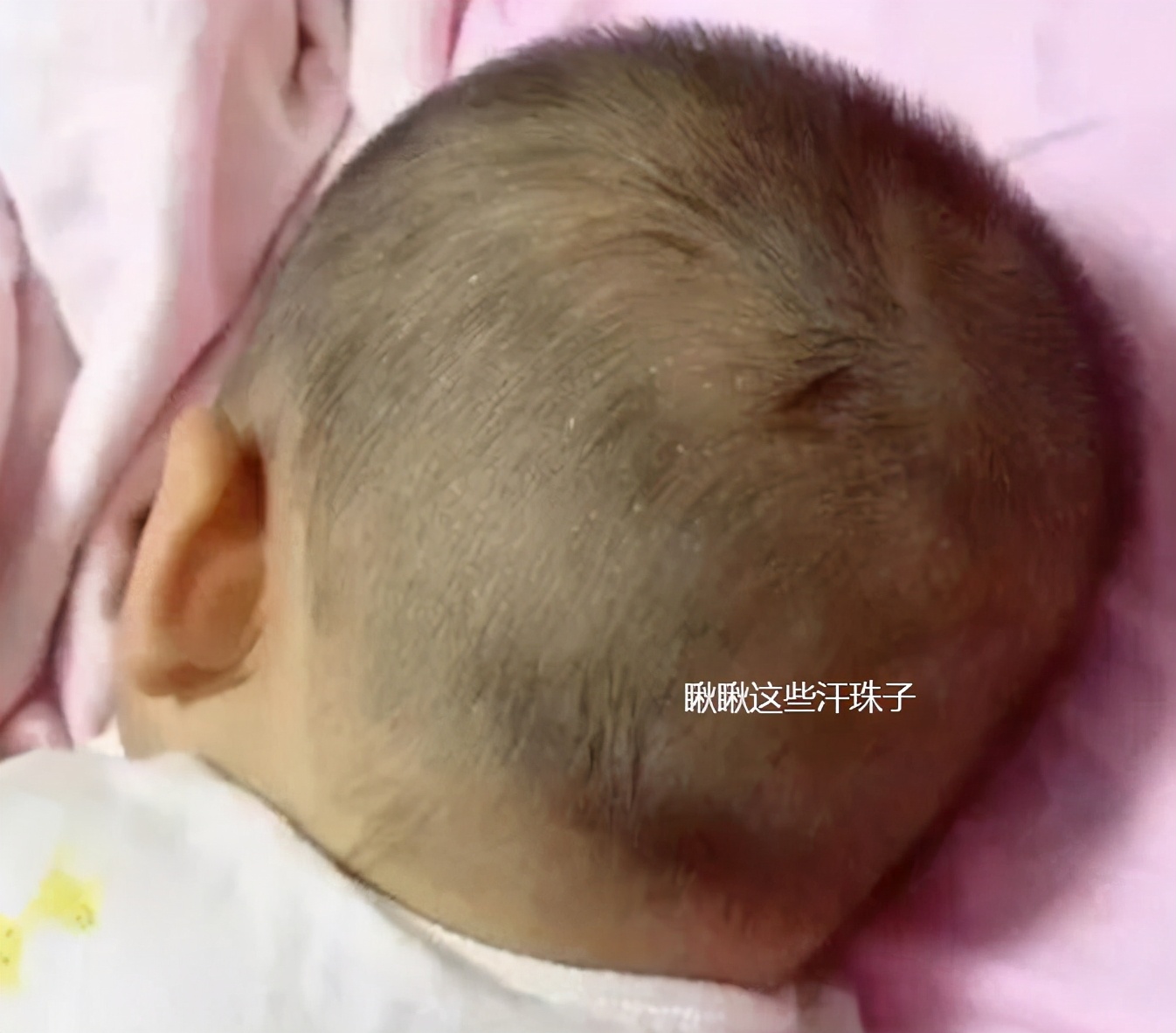 Why Is The Baby Shaking His Head Left And Right When Lying Down In Addition To Not Wanting To Lie Down There May Also Be These 7 Situations Inews